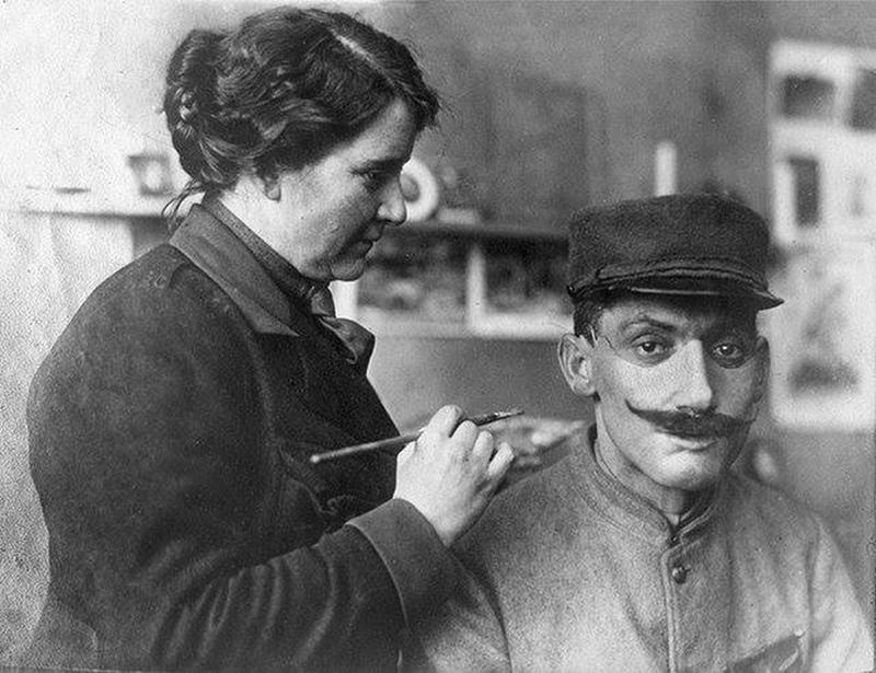 1918: American sculptor Anna Coleman Ladd operated a Parisian studio crafting facial prosthetics for disfigured World War I soldiers.