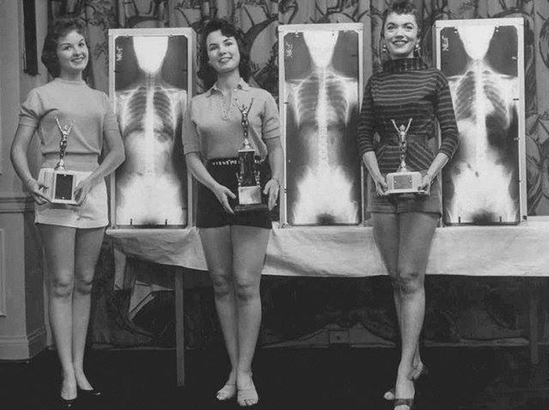 Winners of the 1956 Miss Correct Posture Contest proudly display trophies and X-rays.