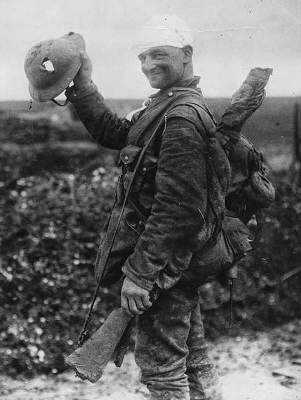 Soldier with a smile displays helmet bullet hole, awaits transfer to medical center in 1917.
