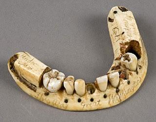 Teeth from dead soldiers used as prosthetics pre-denture invention.