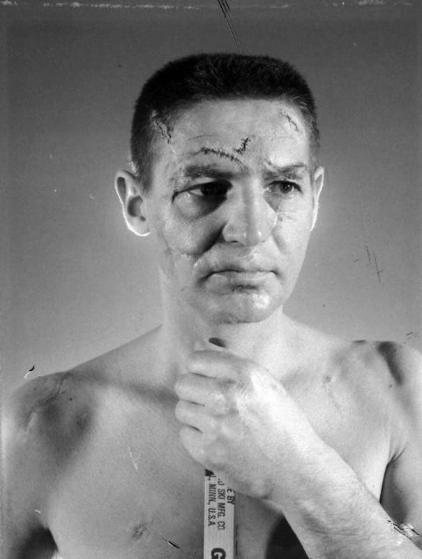 1966: Legendary goalie Terry Sawchuk's face before face-masks became standard in hockey.